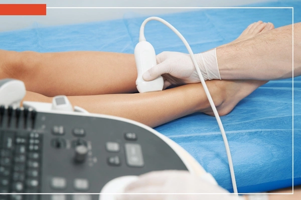 para que sirve eco doppler